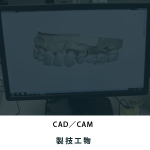 CAD/CAM