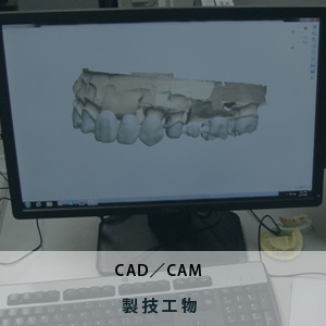 CAD/CAM