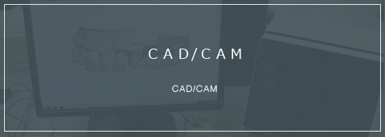 CAD/CAM