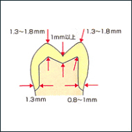 臼歯ジャケットクラウン