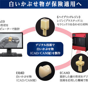 セラスマート 患者様用パンフレット